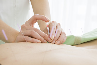 Woman sticks acupuncture into a back