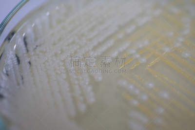 传媒,酵母,大群动物,细菌,微生物学,放线菌属,实验室,霉菌,学习