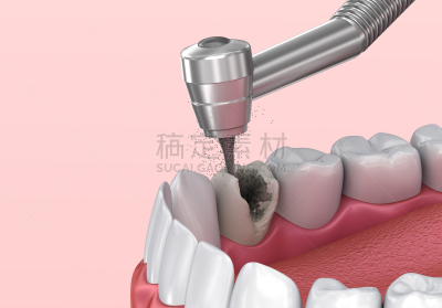 三维图形,准确,插画,人的牙齿,人造的,人,健康保健,遮护的手势,金属,陶瓷制品
