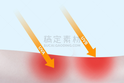 手臂,皮肤,女人,黑色素,癌,黑色素瘤,紫外线辐射,生物医学插图,四肢,水平画幅