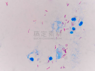 结核杆菌,红色,蓝色背景,分枝杆菌,粘液,细菌,染料,显微镜,实验服