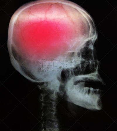 人,x光,成年的,人体,人类肺脏,人体内脏器官,人类心脏,胸部,手,骨骼