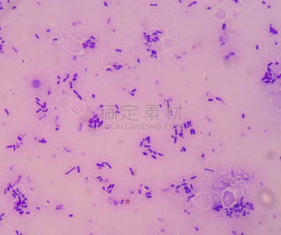 脓毒症,新生活,败血病,水平画幅,微生物学,无人,有毒生物体,生物学,炎症,特写