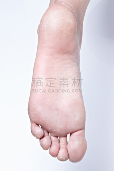 干的,足,细胞,粗糙的,脚掌,死皮,健康保健,背景分离,皮肤病学,健康