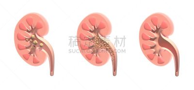 三维图形,里面,肾脏,解剖模型,生物学,有序,健康保健,部分,清新,背景分离