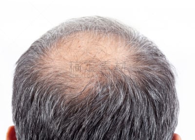 非全秃,男性,仅男人,仅成年人,疲劳的,头发,哀悼者,人的头部,35岁到39岁,中年人