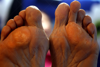 玉米,足,脚掌,蜈蚣,漆的,美,替代疗法,辅导讲座,水平画幅,spa美容
