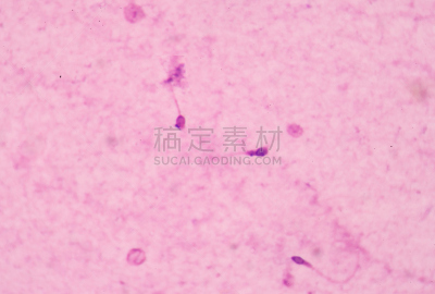 精子,人,有序,水平画幅,显微图片,蓝色,绘画插图,教育科目,颜色处理,生物学