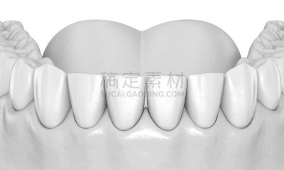 人,绘画插图,牙齿,准确,三维图形,人的牙齿,人的嘴,假牙,牙医