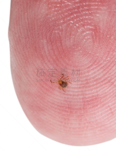 小的,鹿蜱,手指,男人,垂直画幅,在下面,正下方视角,拇指,特写