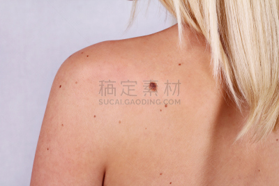 背面视角,皮肤,青年女人,褐色,水平画幅,检查,青年人,放大镜,后背,成年的