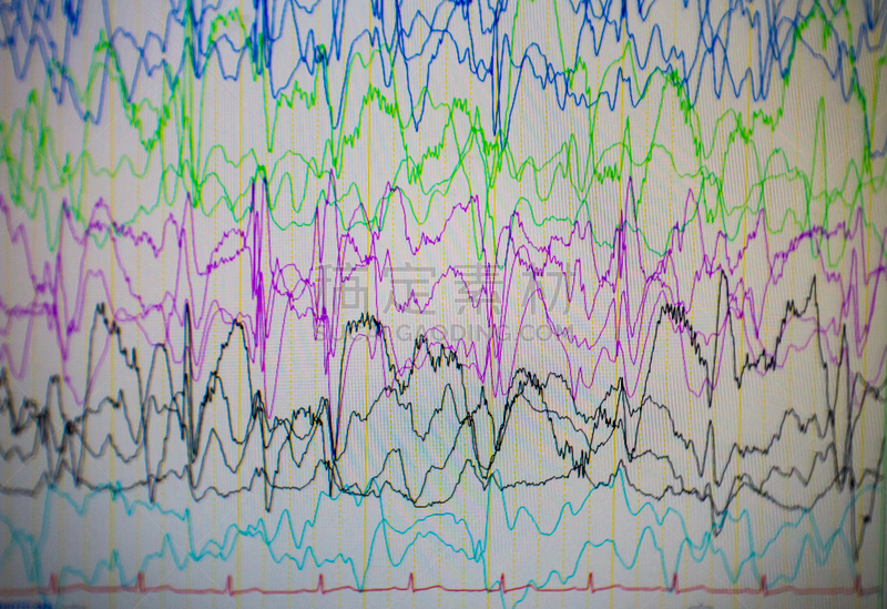 脑部,电,脑电图,问题,病人,儿科医师,奇异的,显示器,神经系统,水平画幅