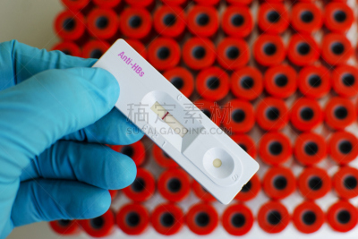 底片,生物学,微生物学,健康保健,化学,医学检测,生物科技,科学实验,技术