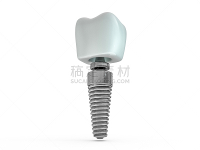 牙医,塑胶,三维图形,牙移植,男人,牙齿,计划书,药,口腔卫生,健康保健