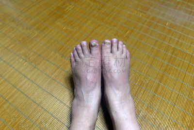 脚气,爪,水平画幅,人类脚趾,古老的,恐惧,特写,真菌,韩国,痛苦