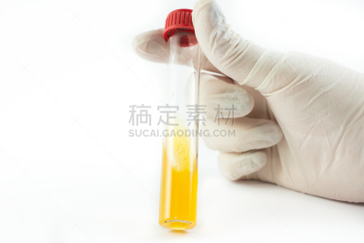 试管,细菌,实验室,拿着,手套,动物手,生物学,微生物学,健康保健,医学检测