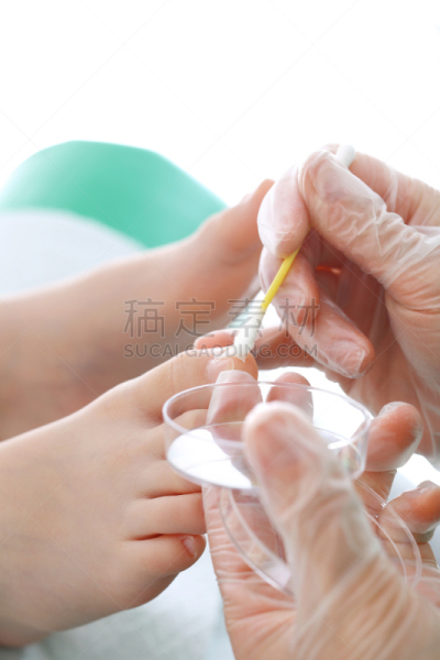 甲真菌病,药,垂直画幅,癣菌,实验室,部分,波兰,成年的,儿童