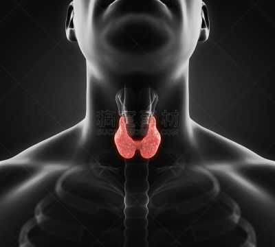 甲状腺,绘画插图,人,水平画幅,甲亢,癌症,科学,计算机制图,计算机图形学