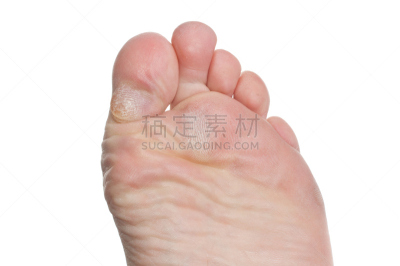 人类脚趾,部分,背景分离,韧性,皮肤病学,健康,化妆用品,儿童,在下面,人体
