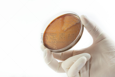 皮氏培养皿,细菌,拿着,手套,动物手,白色,微生物学,背景分离,科学家,图像