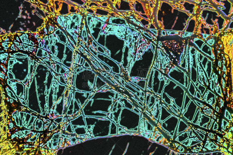 辉岩,抽象,微生物学,数字增强,活力,偏振光,显微镜,显微图片,图像处理,色彩鲜艳