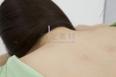 针灸,女人,健康保健,药,平衡折角灯,针灸师,僵硬的肩膀,新陈代谢,淋巴系统,中医