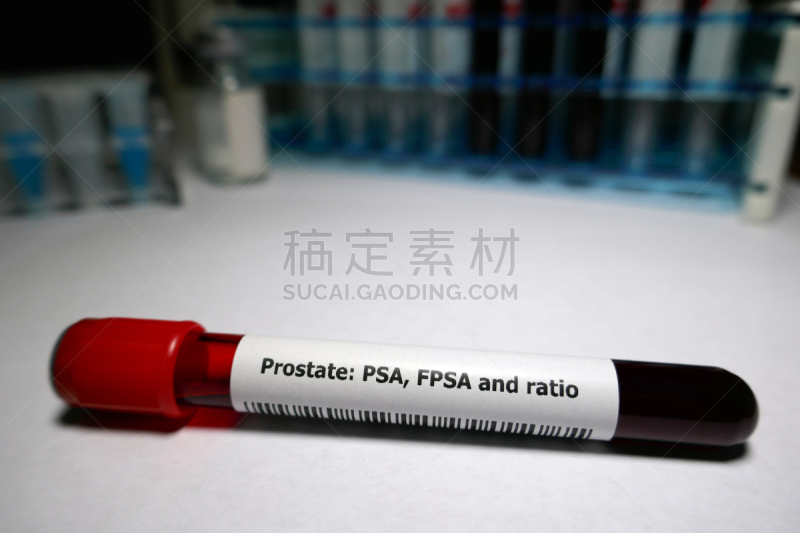 前列腺癌,癌症,肿瘤,技术,健康保健,图像,前景聚焦,抽象,水平画幅,特写