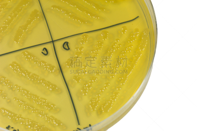 皮氏培养皿,细菌,大群动物,琼脂,牢房,植物细胞,明胶,药剂师,餐具,水平画幅