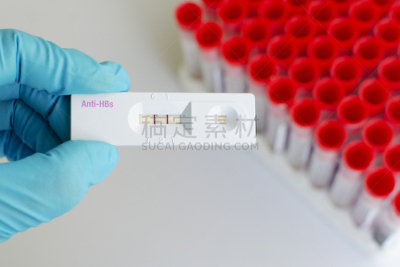 表现积极,生物科技,水平画幅,微生物学,科学实验,科学,生物学,实验室,肝炎
