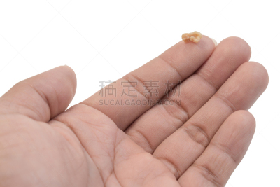扁桃体,公亩,分离着色,手掌,白色背景,喉咙,舌头,水平画幅,使用嘴巴,呼吸系统
