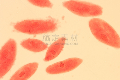 尾草履虫,动物,草履虫,阿米巴,光显微图,浮游生物,原生动物,标本架,大规模的放大,细胞核