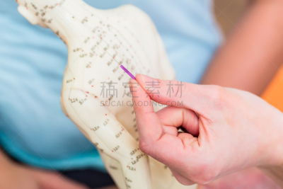 个性,针灸,全科医师,水平画幅,白人,针灸师,部分,专业人员,成年的,女人
