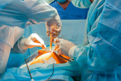 peritoneal cavity,复杂性,手,四只动物,腹腔镜手术,水平画幅,科学,制服,特写,内诊镜