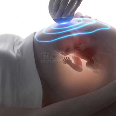 3d超声,概念,妇产科医师,胎儿,肚脐,形状,父母,腹腔,白人,新生活