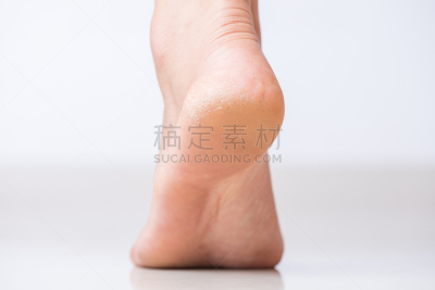 健康保健,破碎的,皮肤,足,特写,概念,皮炎,部分,背景分离,皮肤病学
