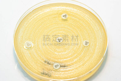 盘子,医学检测,小的,餐具,生物科技,水平画幅,微生物学,无人,科学,风险