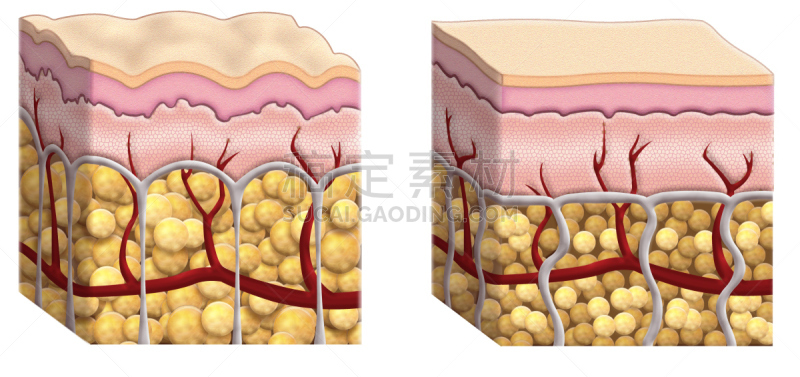 横截面,皮下的,毛细血管,真皮层,人体胶原蛋白,美,水平画幅,绘画插图,全景,图表