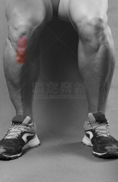肌腱,髌韧带,髌骨,膝,垂直画幅,身体受伤,四肢,人类肌肉,腿,运动员