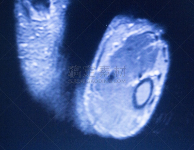 磁共振成象扫描,动物手,指纹扫描仪,charles ray,腕骨,mri扫描仪,韧带,医学扫描,结论,医疗保险
