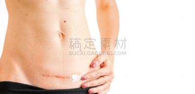健康保健,女人,疤,英文字母c,米色,概念,分离着色,肚子,白色背景,恢复