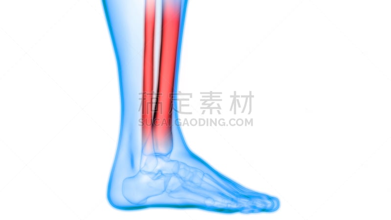 人类骨架,痛苦,关节,骨骼,身体受伤,替代疗法,辅导讲座,悲痛,股骨