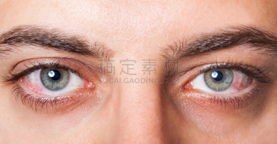 红色,眼痛,水平画幅,男人,毛细血管,人,成年的,特写,愤怒,摄影