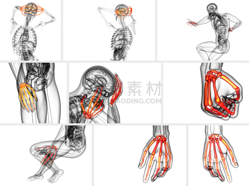 人类骨架,三维图形,手,绘画插图,趾骨,风湿病,骨质疏松症,关节炎,水平画幅,泰国