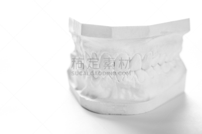 人的嘴,石膏肥料,白色背景,模型,人,石膏,水平画幅,表格,牙医,科学