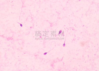精子,人,有序,水平画幅,显微图片,蓝色,绘画插图,教育科目,颜色处理,生物学