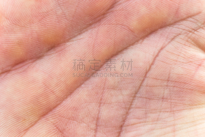 平视角,手,皮肤,里面,角膜,汗腺,水平画幅,形状,盾,蝴蝶结