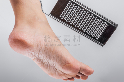 足,干的,特写,分离着色,白色背景,女人,脚病医生,蜈蚣,鞋底,皮肤病学