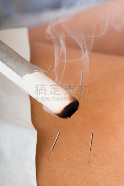 艾灸,针灸,组图,吸烟问题,棍,针灸师,垂直画幅,医疗流程,健康保健