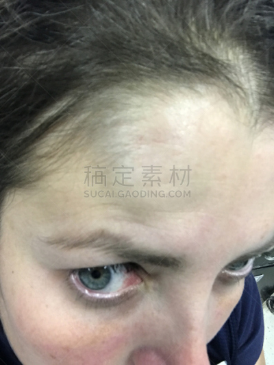 人的头部,崎岖不平,青年女人,身体受伤,垂直画幅,头痛,美国,仅一个女人,人