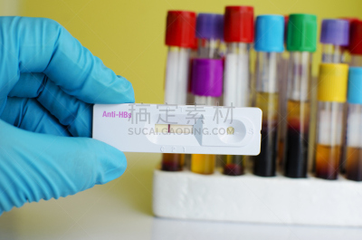 底片,生物学,微生物学,健康保健,化学,医学检测,生物科技,科学实验,技术